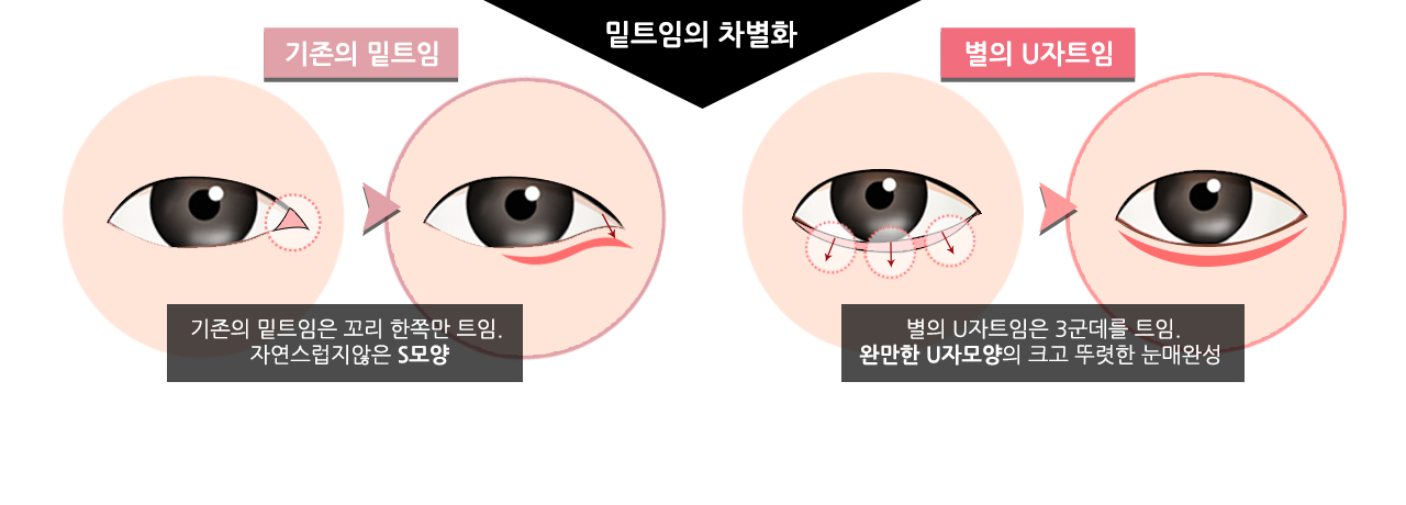 별성형외과 성형외과에 대한 생각을 바꾸다